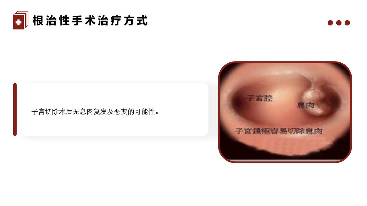 子宫内膜息肉的护理PPT课件15