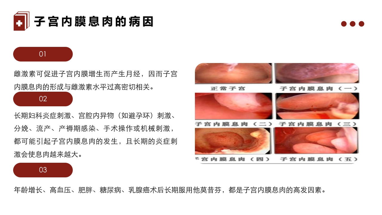 子宫内膜息肉的护理PPT课件5