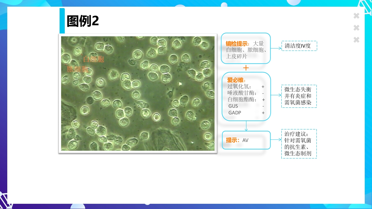 女性下生殖道感染疾病的诊断方法ppt课件51