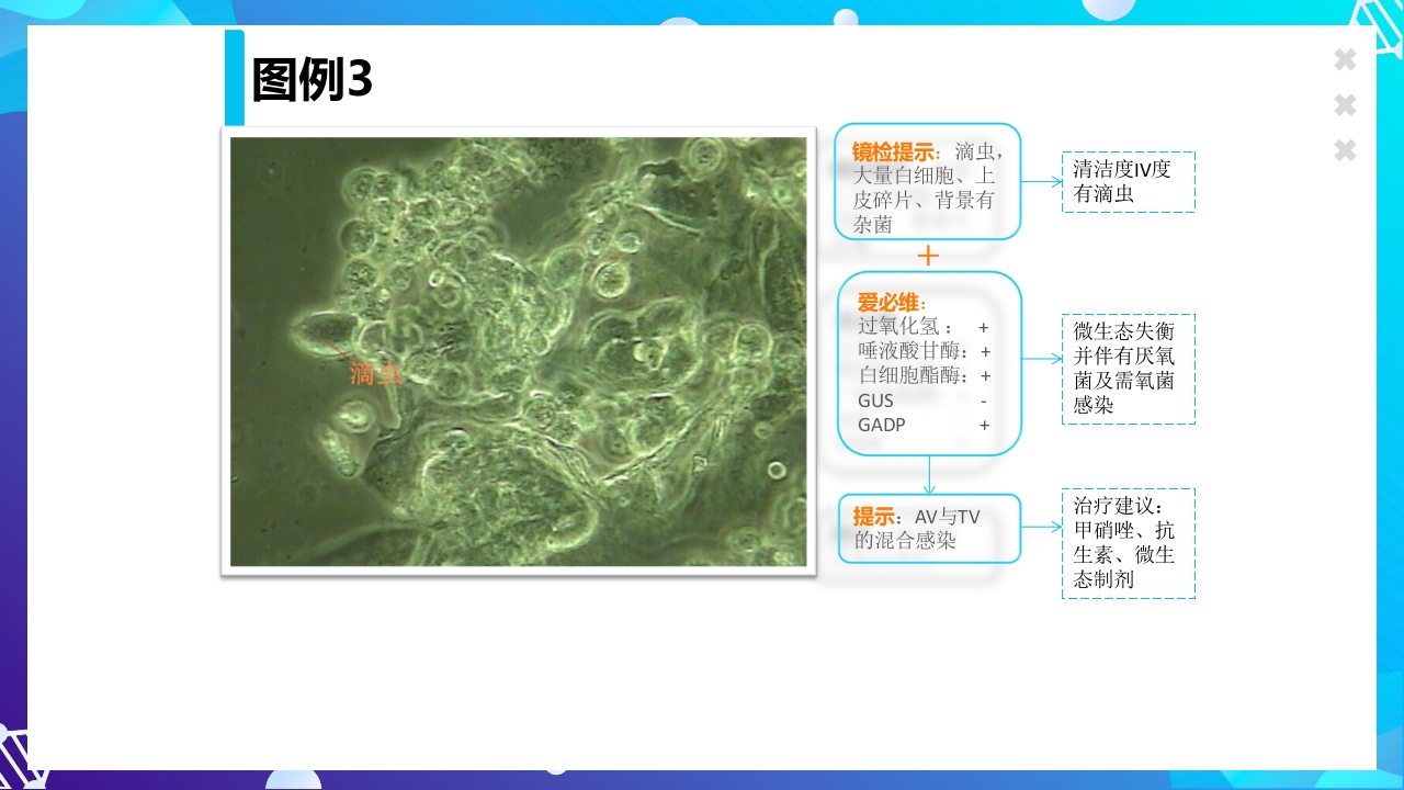 女性下生殖道感染疾病的诊断方法ppt课件52