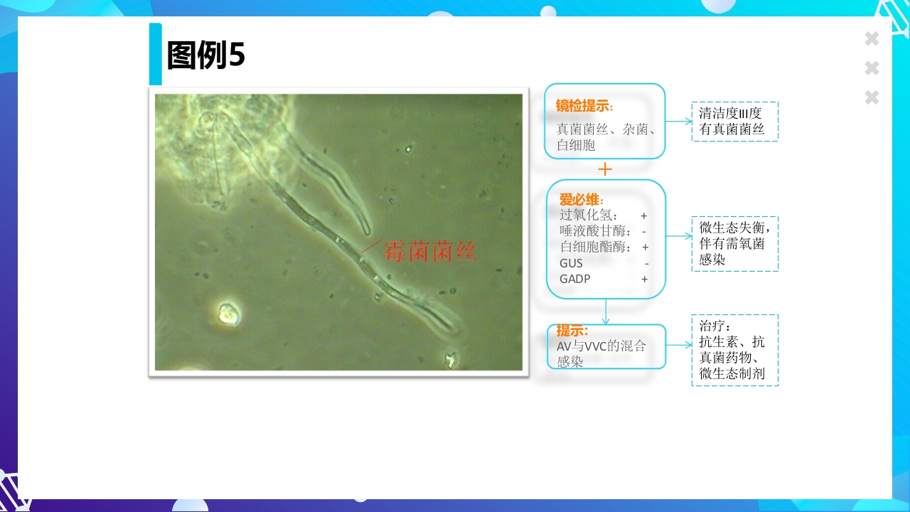 女性下生殖道感染疾病的诊断方法ppt课件54