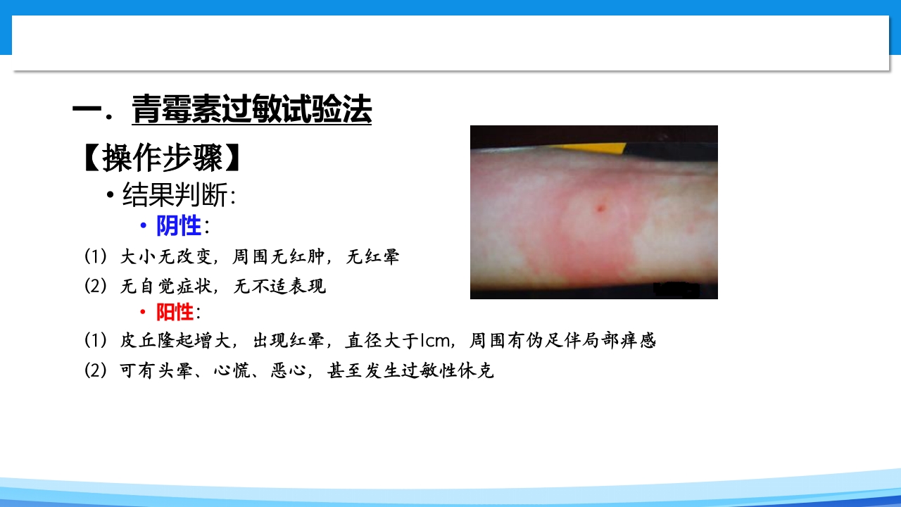 青霉素过敏试验PPT课件6
