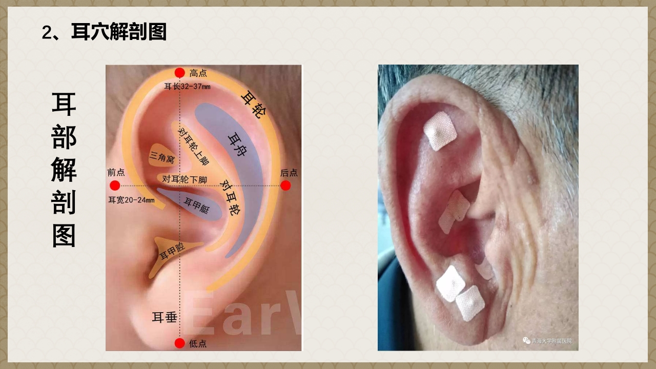 耳穴贴压技术PPT课件5
