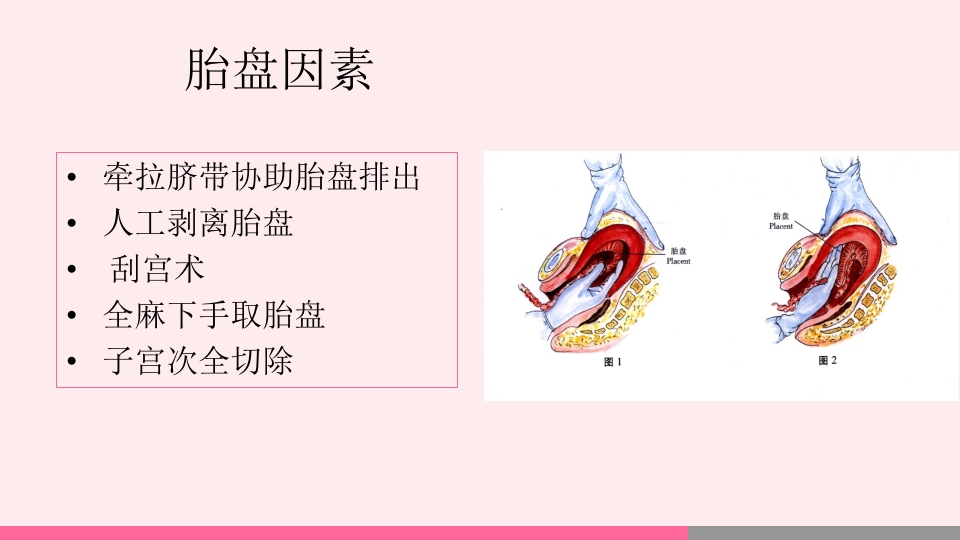 产后出血的观察与护理PPT课件25