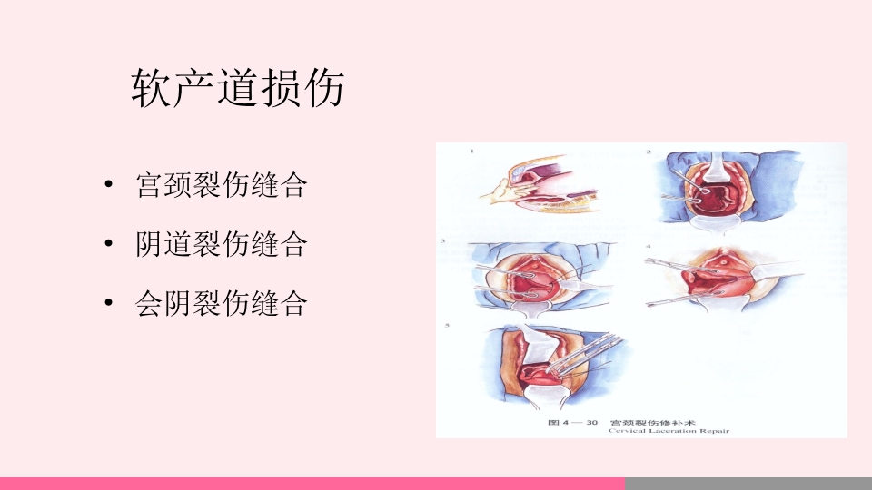 产后出血的观察与护理PPT课件26