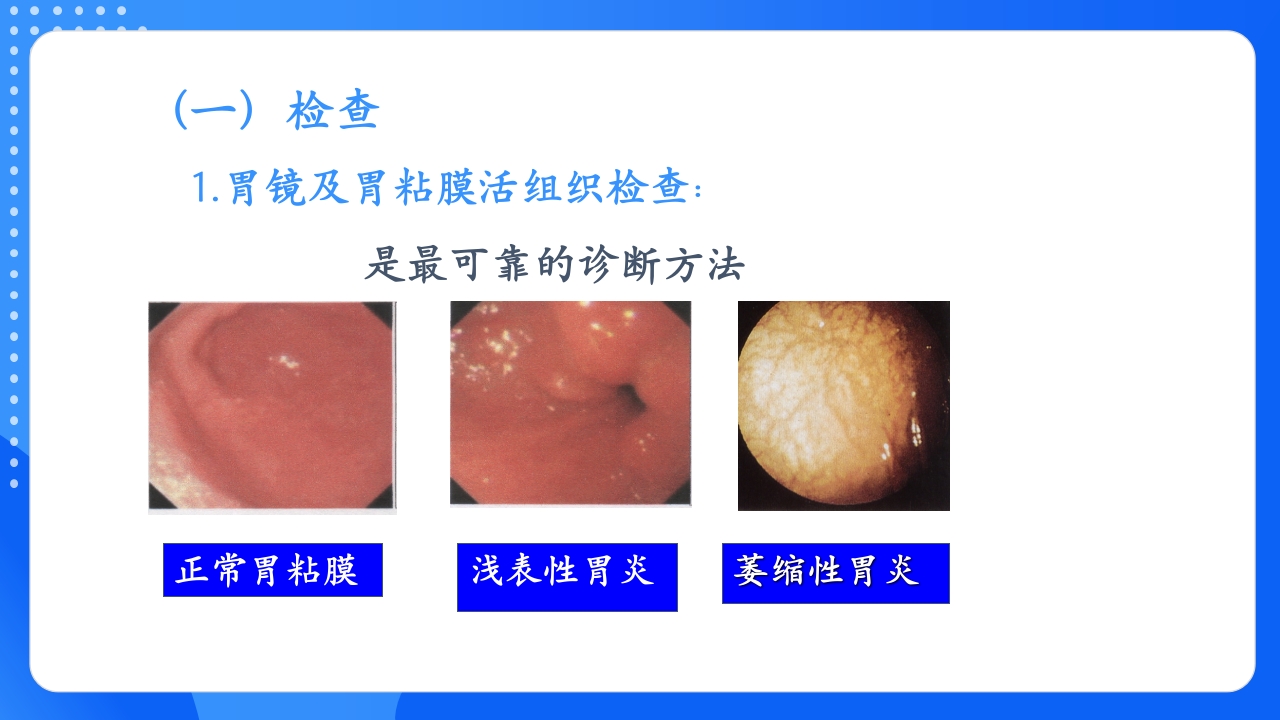 慢性胃炎护理查房PPT课件15