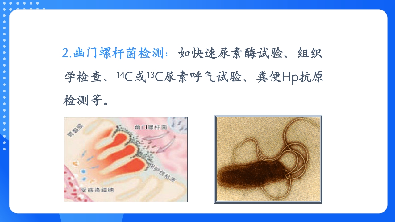 慢性胃炎护理查房PPT课件16