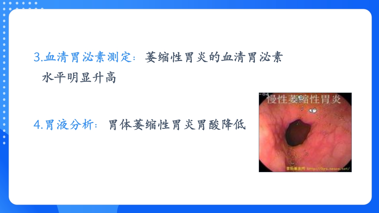 慢性胃炎护理查房PPT课件17