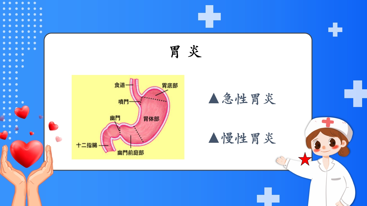 慢性胃炎护理查房PPT课件2