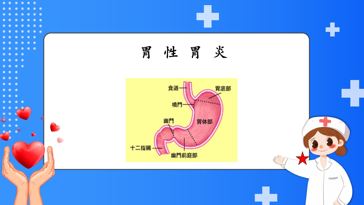 慢性胃炎护理查房PPT课件4