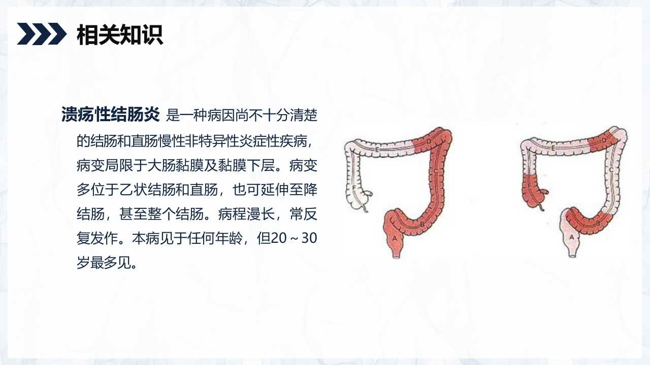 溃疡性结肠炎护理查房PPT课件4