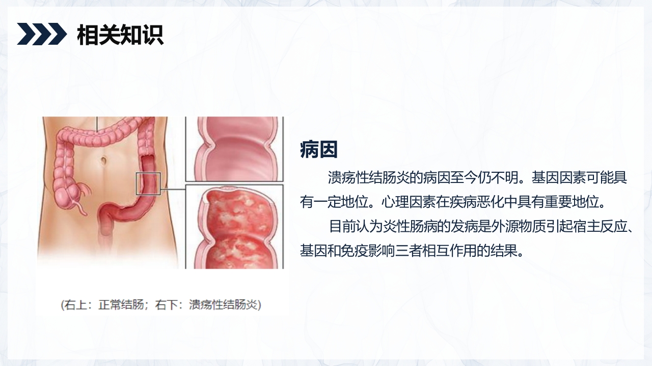 溃疡性结肠炎护理查房PPT课件5