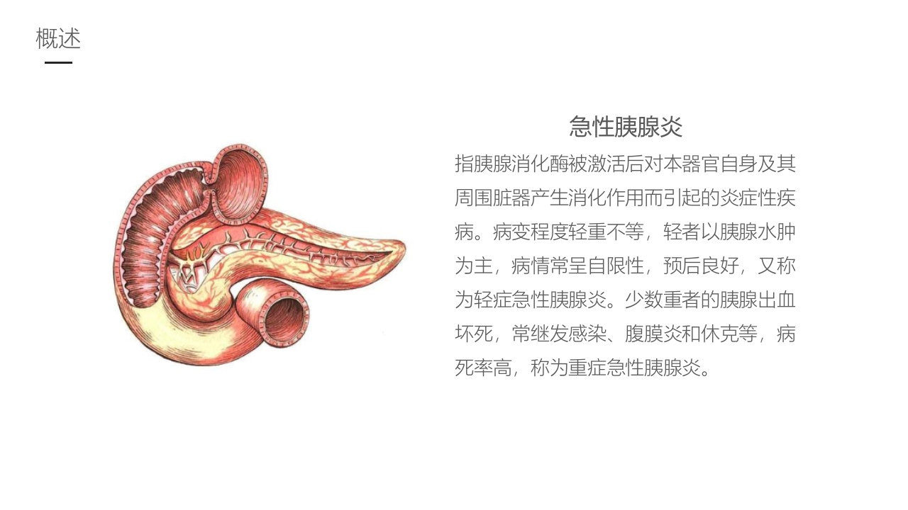 急性胰腺炎护理业务学习PPT课件5