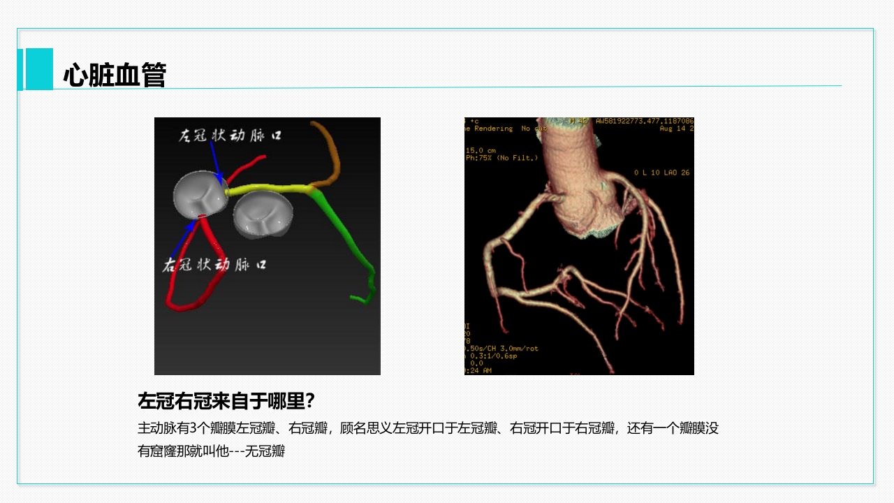 心脏血管介绍分析教学PPT课件21