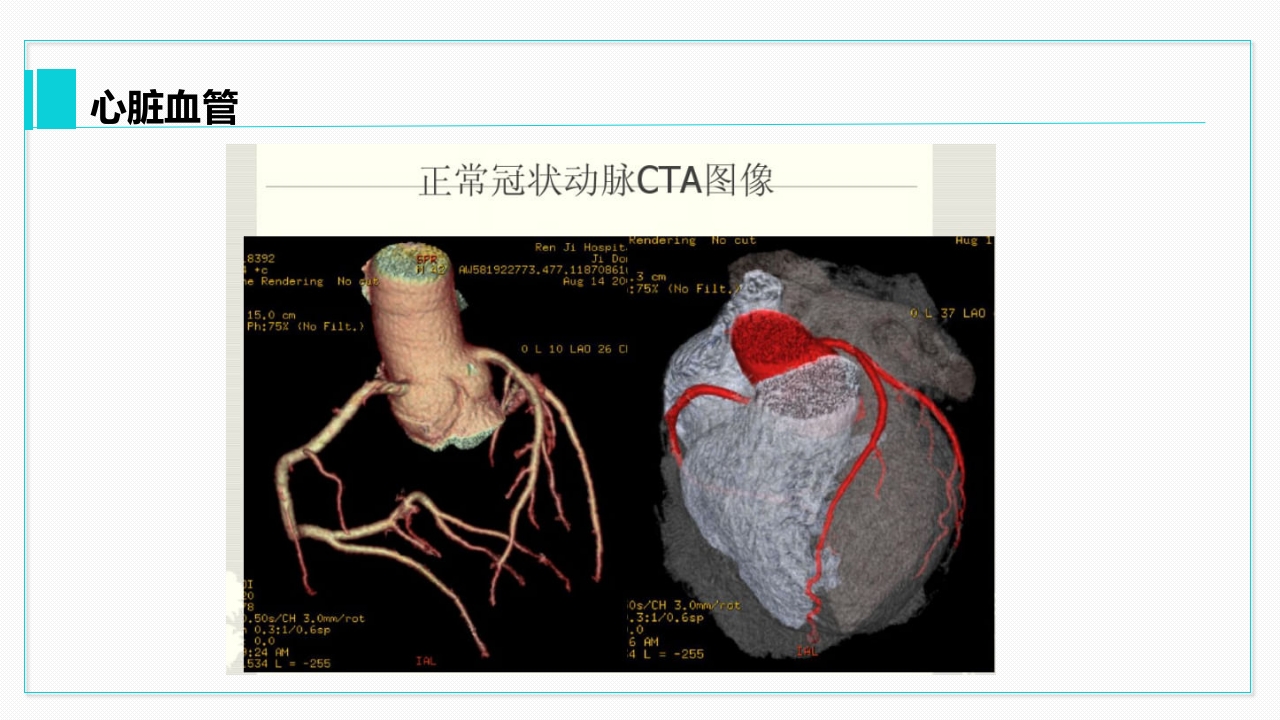 心脏血管介绍分析教学PPT课件31