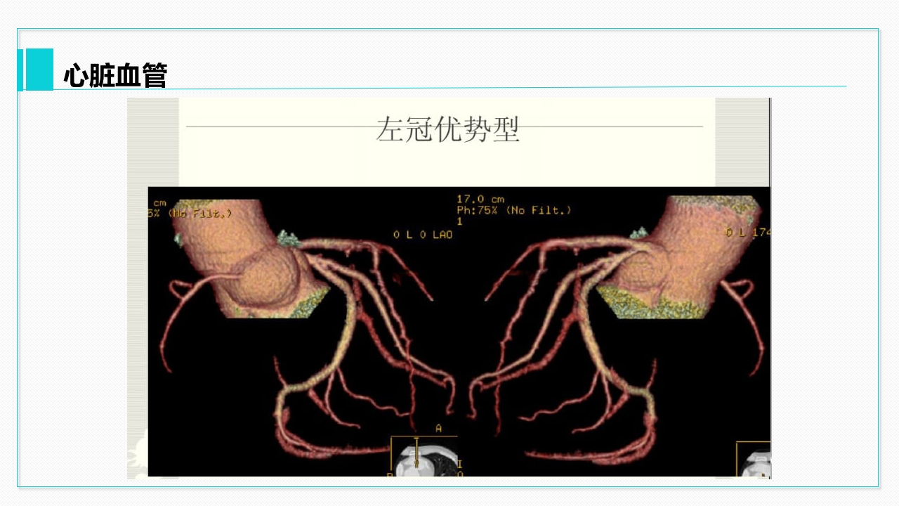 心脏血管介绍分析教学PPT课件32
