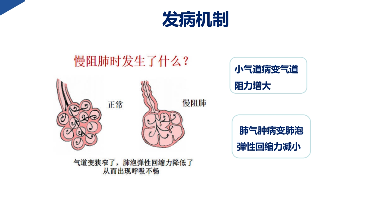 COPD慢阻肺患者诊断与评估护理PPT课件-压缩7