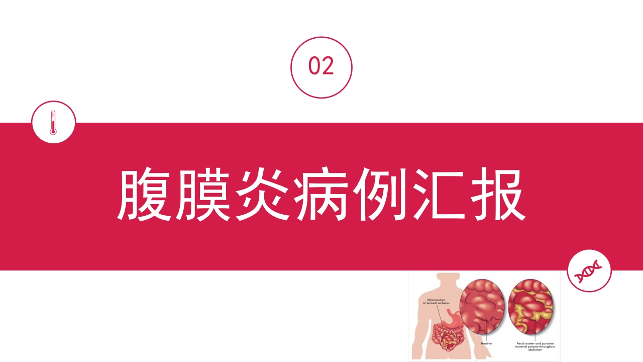 急性腹膜炎患者护理查房PPT课件14