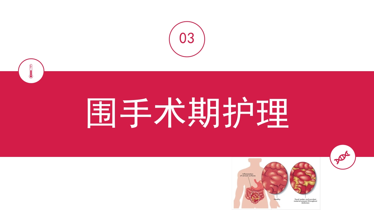 急性腹膜炎患者护理查房PPT课件17