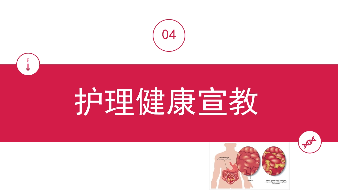 急性腹膜炎患者护理查房PPT课件29