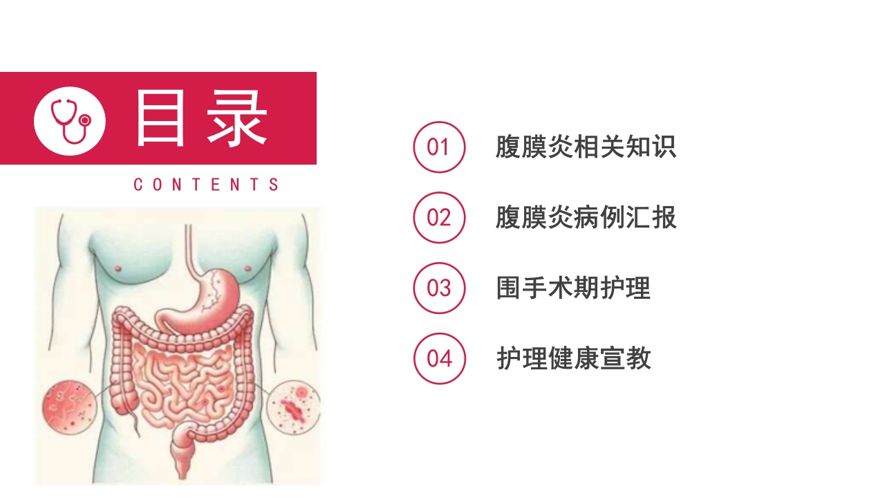 急性腹膜炎患者护理查房PPT课件2