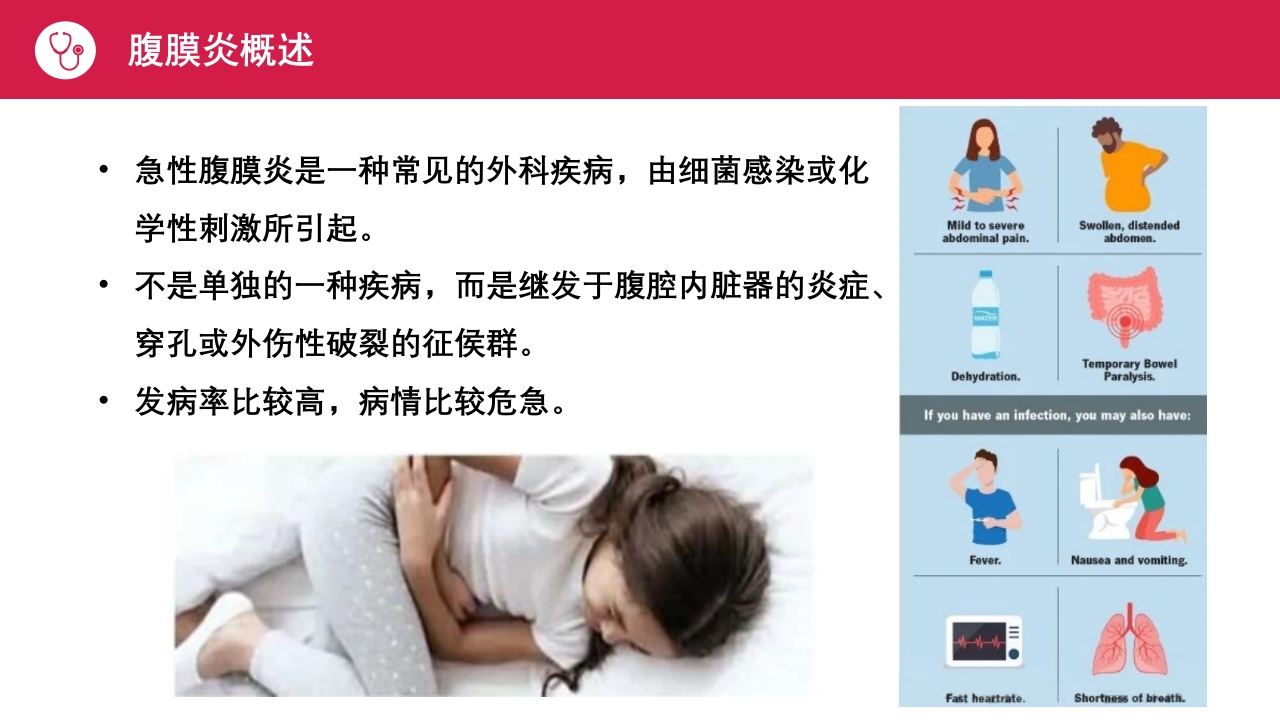 急性腹膜炎患者护理查房PPT课件4