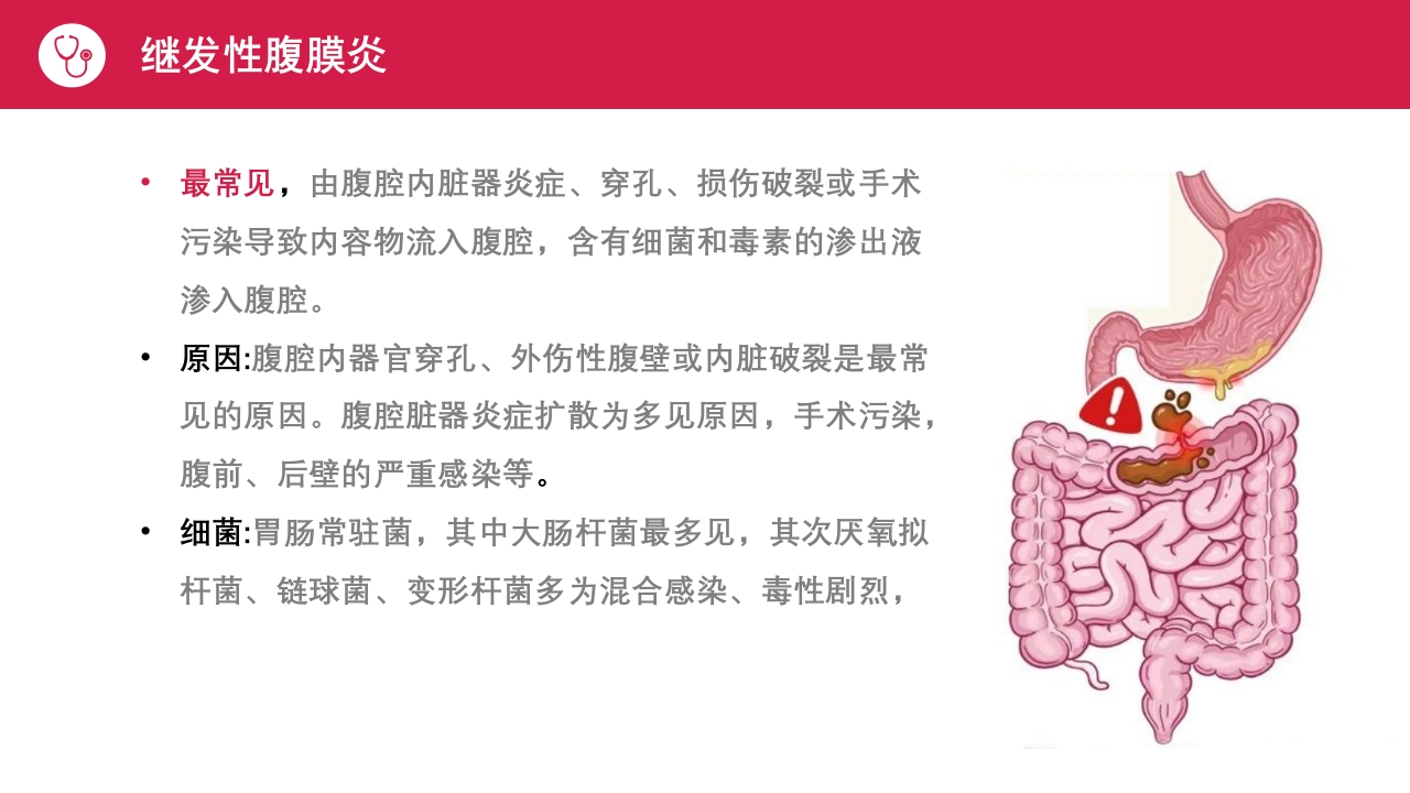 急性腹膜炎患者护理查房PPT课件9