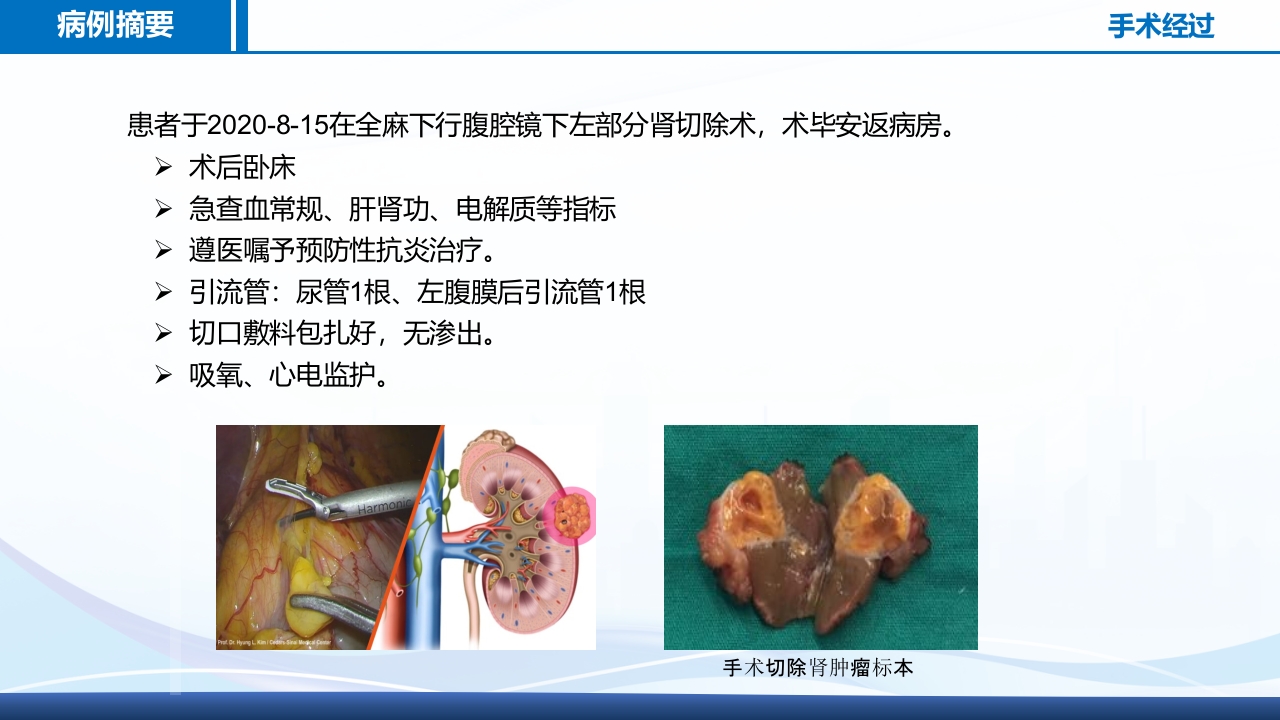 腹腔镜肾部分切除术护理查房PPT课件18