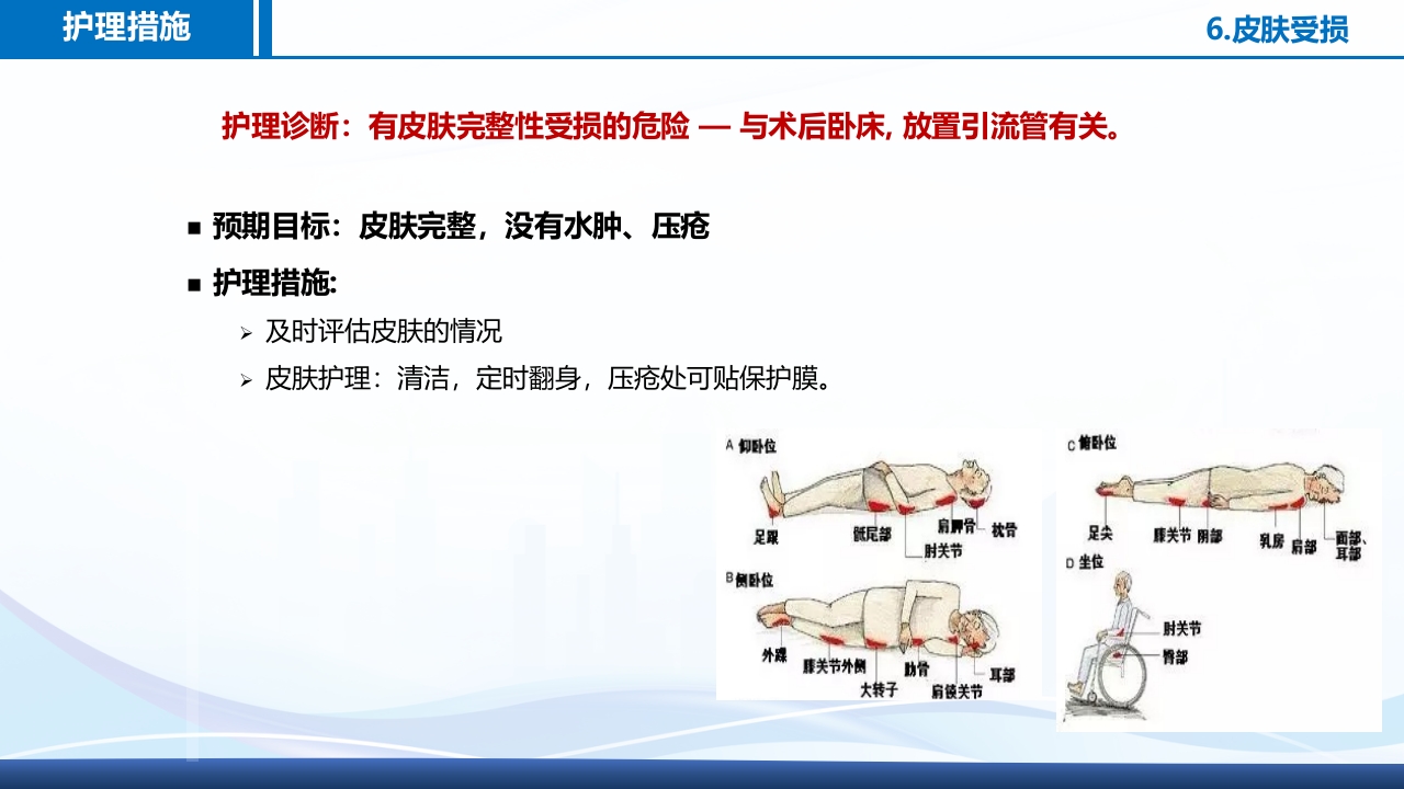 腹腔镜肾部分切除术护理查房PPT课件30