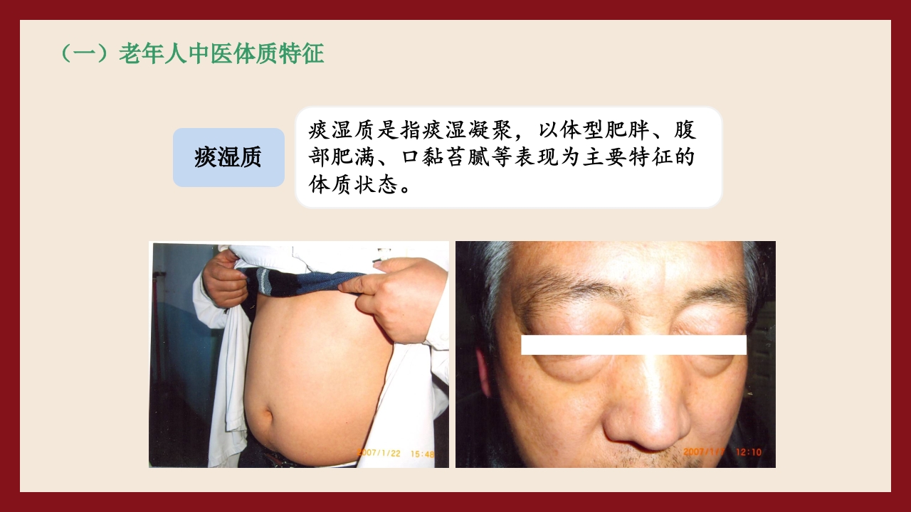 老年人中医体质辨识与保健方法PPT课件23