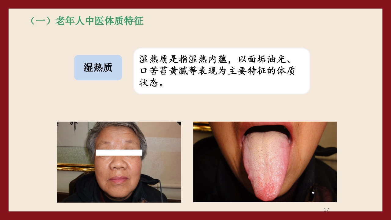 老年人中医体质辨识与保健方法PPT课件27