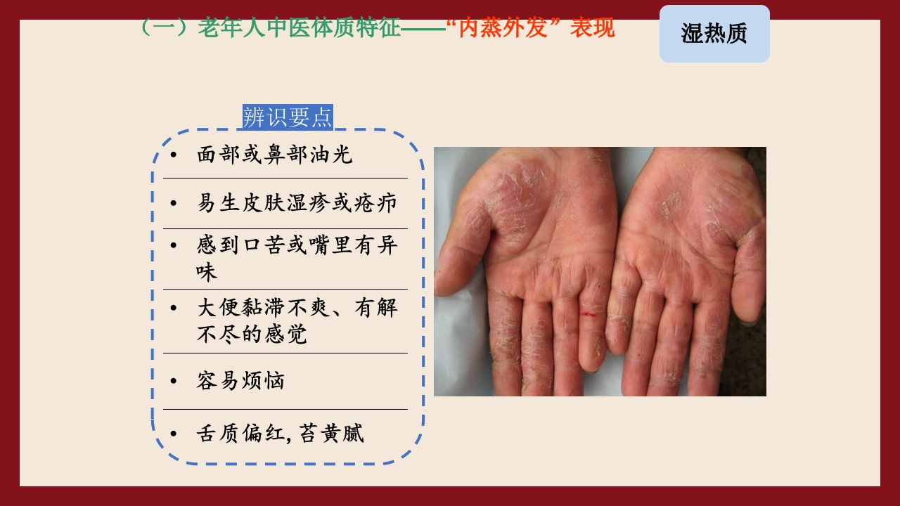 老年人中医体质辨识与保健方法PPT课件29