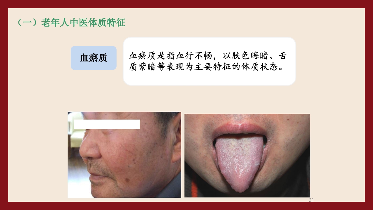 老年人中医体质辨识与保健方法PPT课件31