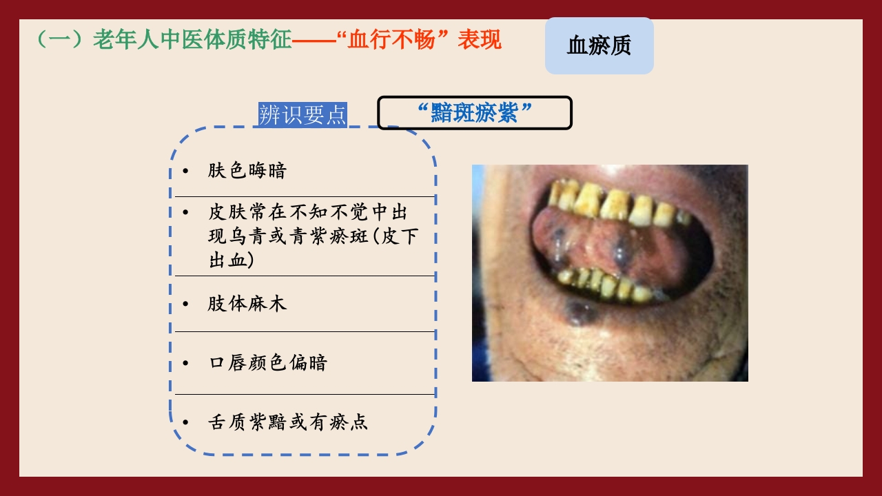 老年人中医体质辨识与保健方法PPT课件33