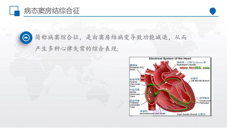 病窦综合征患者个案护理PPT课件4