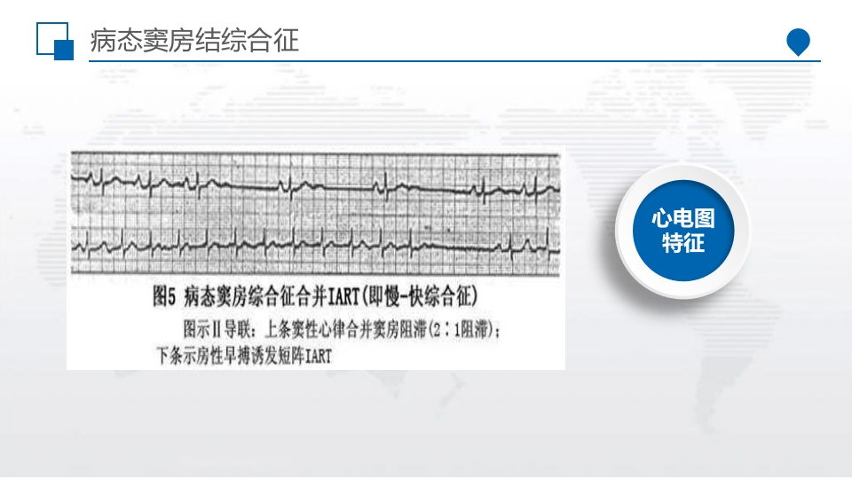 病窦综合征患者个案护理PPT课件7