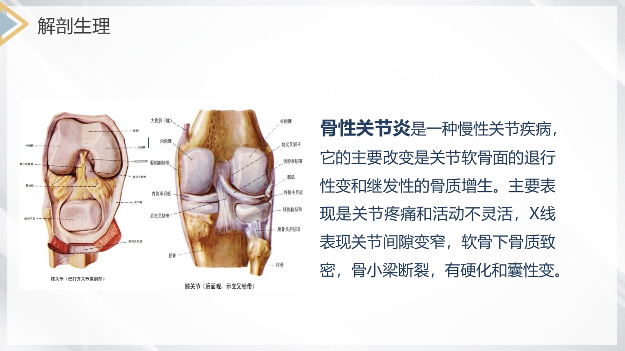双膝骨性关节炎护理查房PPT课件4