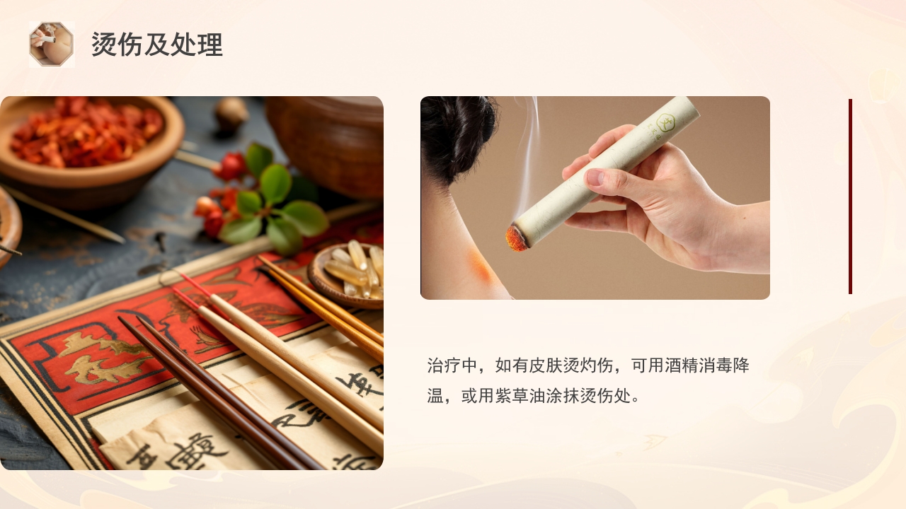 雷火灸技术PPT培训PPT课件24