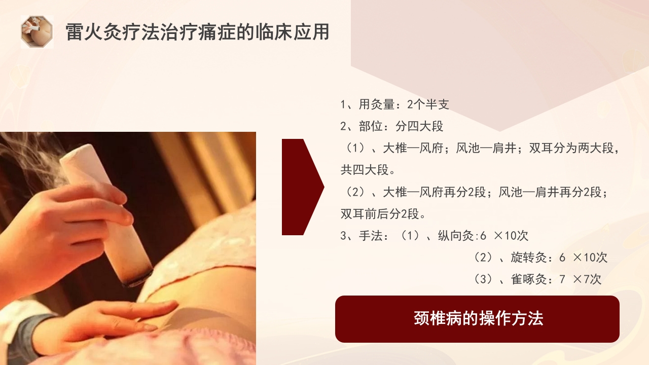 雷火灸技术PPT培训PPT课件30