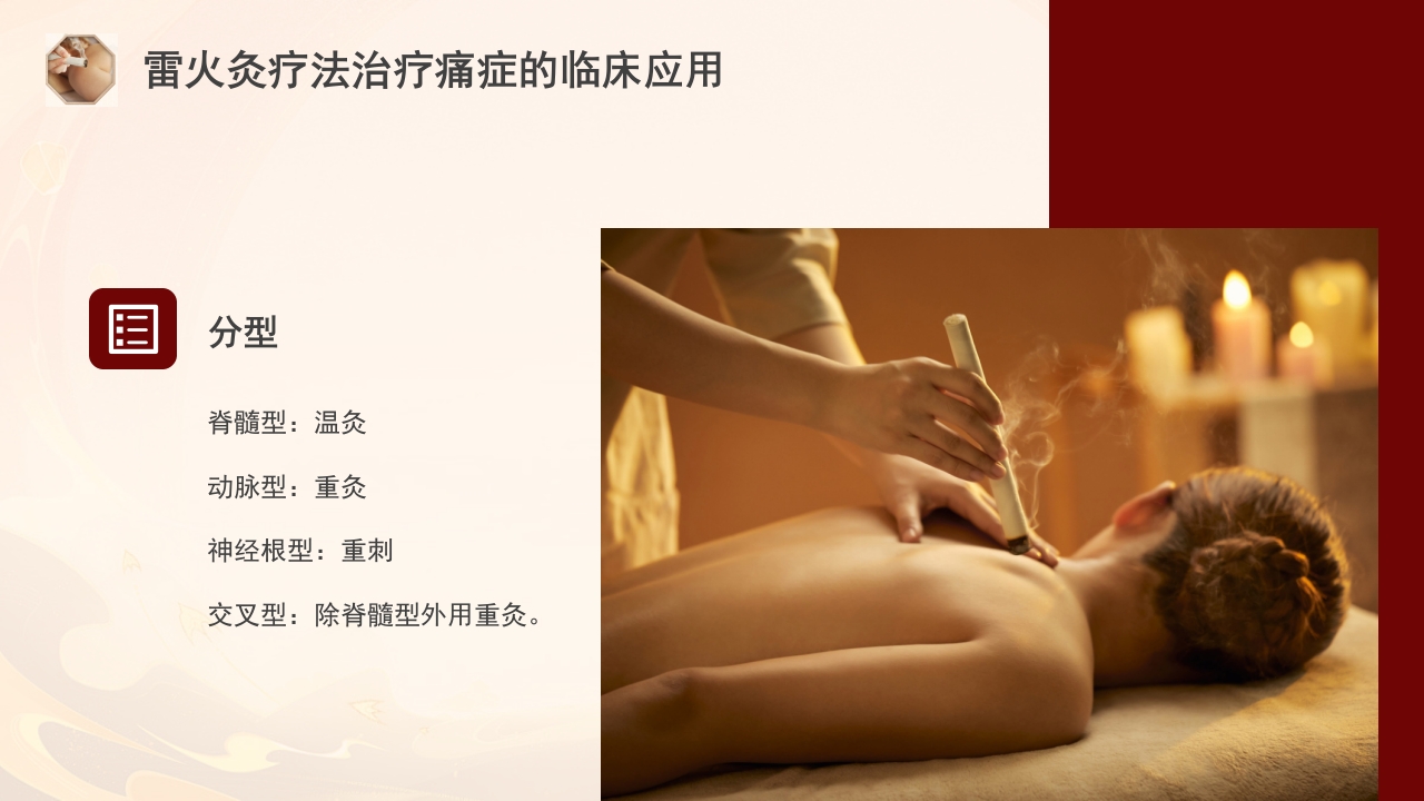 雷火灸技术PPT培训PPT课件31