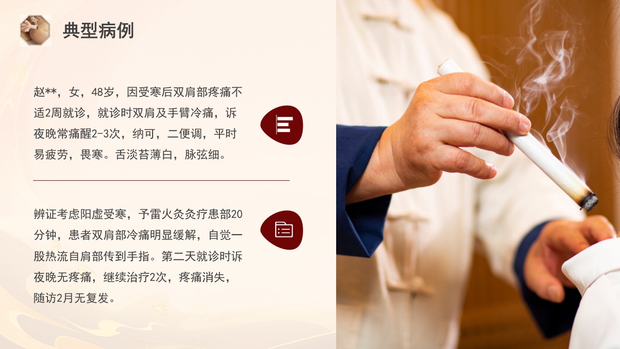 雷火灸技术PPT培训PPT课件33