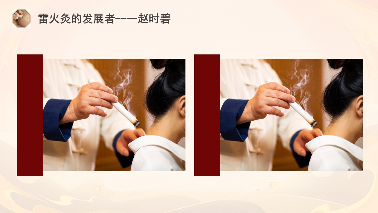 雷火灸技术PPT培训PPT课件5