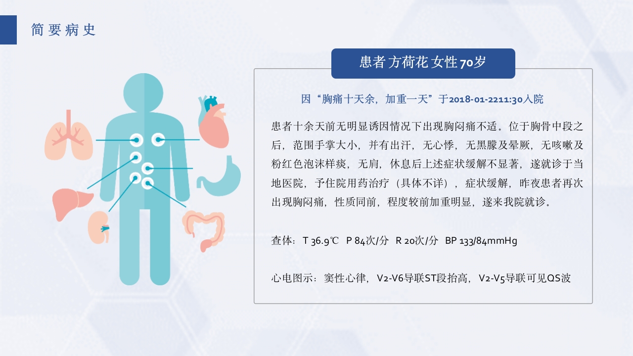 急性心梗护理查房PPT课件4