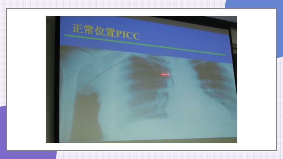 中心静脉导管简介和维护PPT课件20