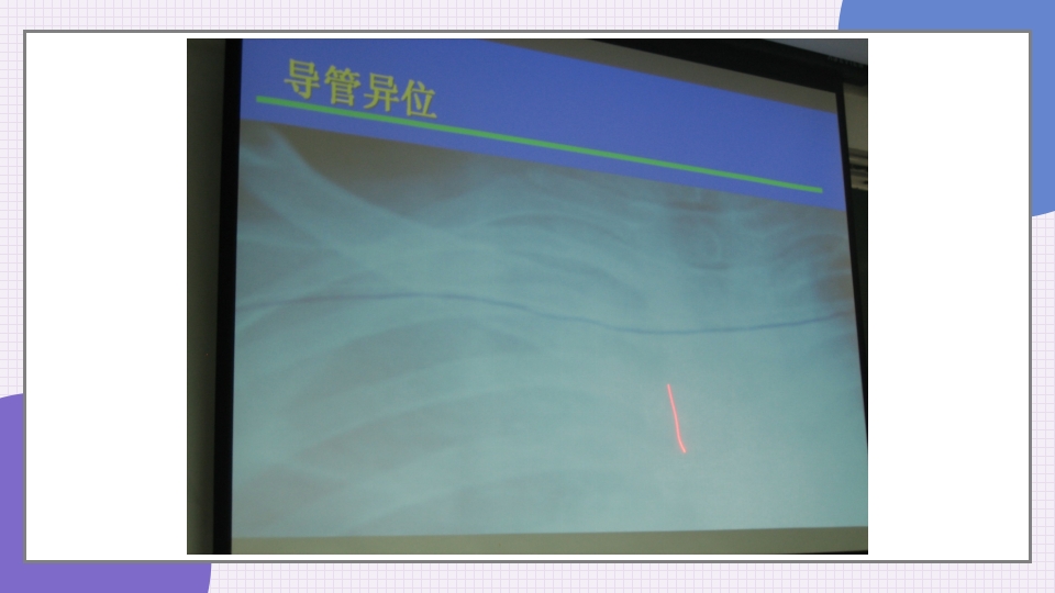 中心静脉导管简介和维护PPT课件22