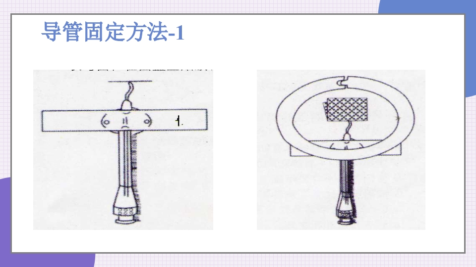 中心静脉导管简介和维护PPT课件38