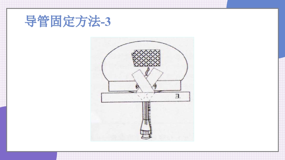 中心静脉导管简介和维护PPT课件40