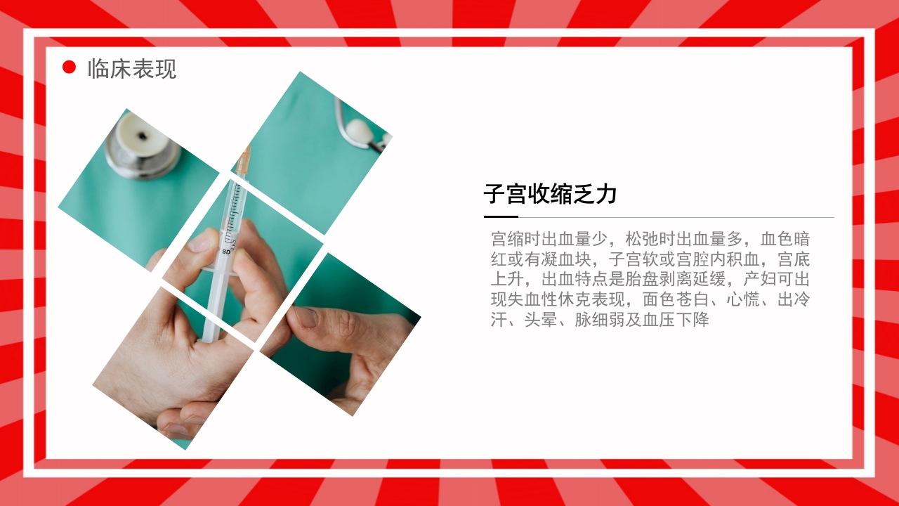 产后出血护理查房PPT课件8