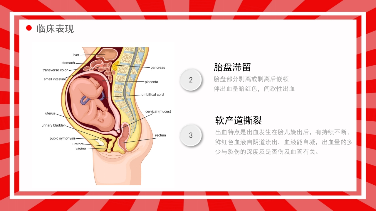 产后出血护理查房PPT课件9