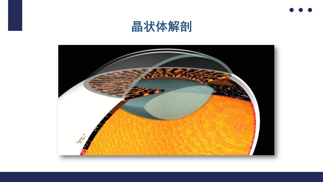 白内障护理教学查房PPT课件4